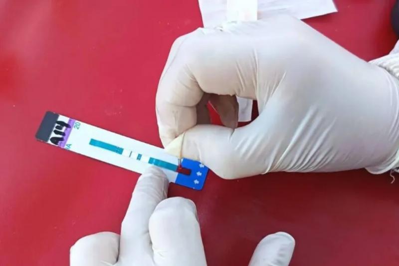 Día Mundial del VIH: hacete el test gratis y de forma confidencial